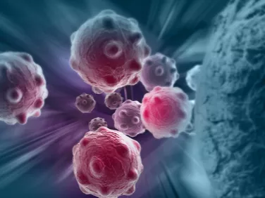 Folyadékbiopszia: a jövő diagnosztikája?
