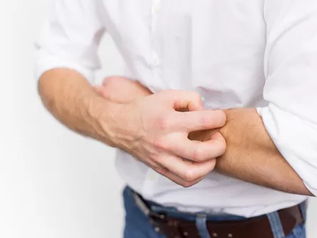 Fejlesztés alatt álló hatóanyagok az atópiás dermatitis kezelésére