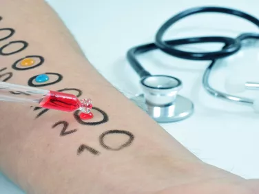 Első vonalbeli diagnosztikai módszer lehet a specifikus-IgE-teszt