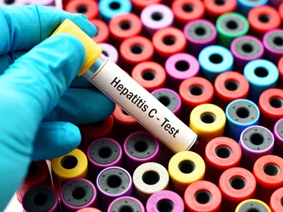Reális cél a HCV-mentes Magyarország