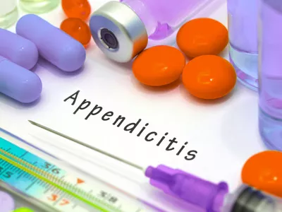 Kiváltható-e antibiotikummal a vakbélműtét?