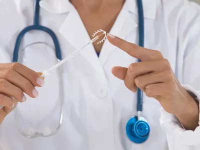 EMA-vizsgálat a hormonális spirálok pszichiátriai mellékhatásairól
