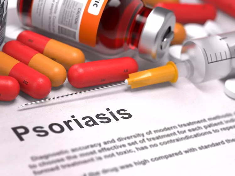 A psoriasis napjainkban