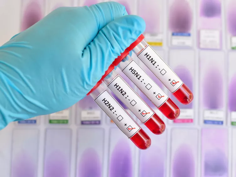 Áttörő kutatási eredmény az influenza elleni küzdelemben