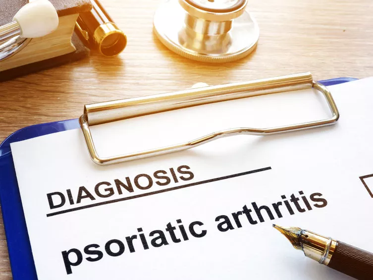 Remények az arthritis psoriatica terápiájában