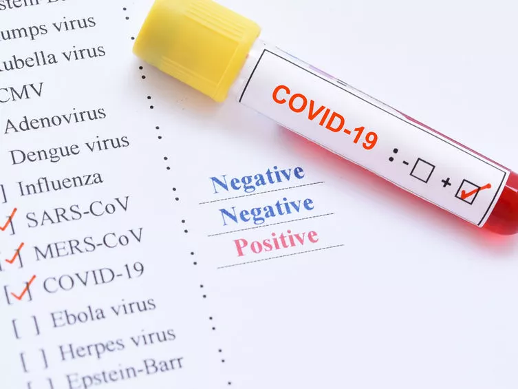 Elkészült az első SARS-CoV-2-antitest-teszt