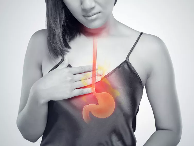 A gastrooesophagealis reflux betegség konzervatív kezelése