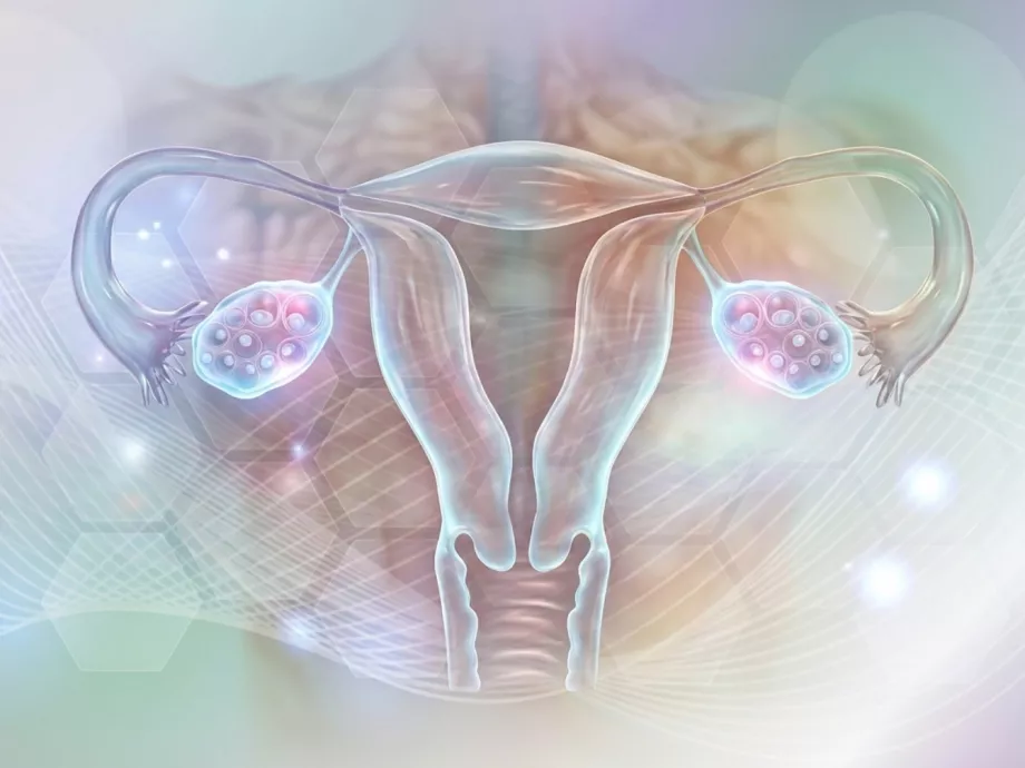 Rendszertelen menstruáció és magas inzulinszint – mikor merül fel PCOS gyanúja?