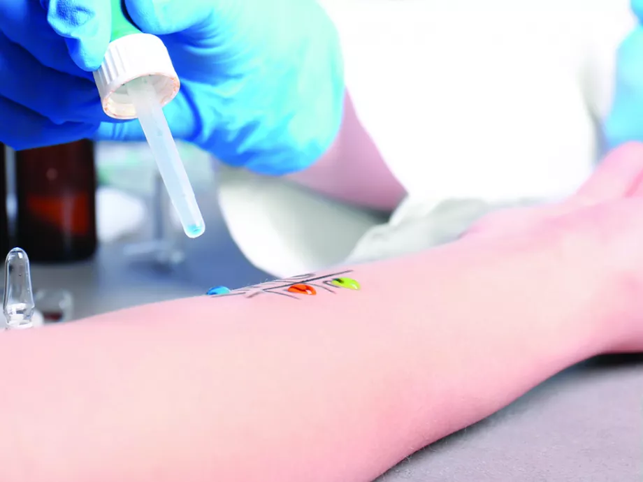 Inhalációs allergén–étel keresztallergia: EAACI állásfoglalás