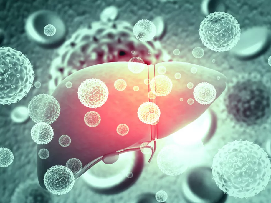 Autoimmun hepatitis – a nehezen kezelhető beteg