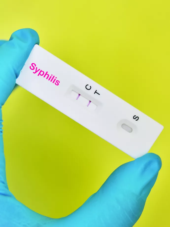 Tünetmentes STI-k: hazai adatok és diagnosztikai módszerek