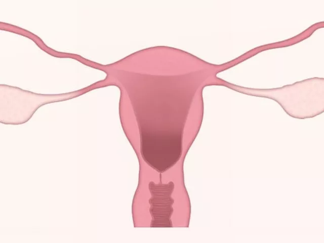 Az endometriózis
nem csak fájdalmat okoz, előrébb hozhatja a változókort is!